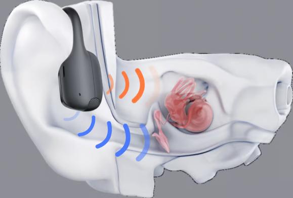  Hörlur SHOKZ OpenRun Pro2 Svart