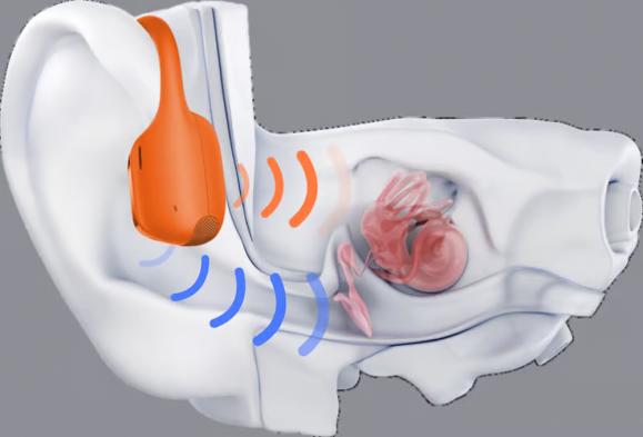  Hörlur SHOKZ OpenRun Pro2 mini Orange