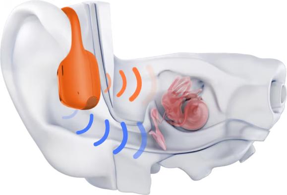  Hörlur SHOKZ OpenRun Pro2 Orange